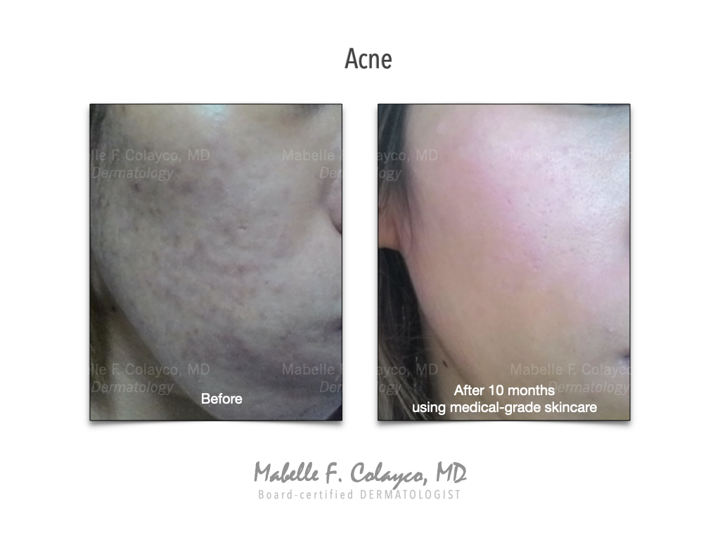 Good Skincare = Good Skin