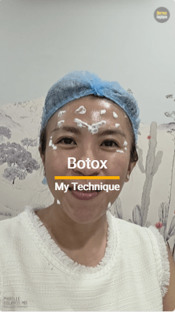 Botox: Sharing My&nbsp;Technique