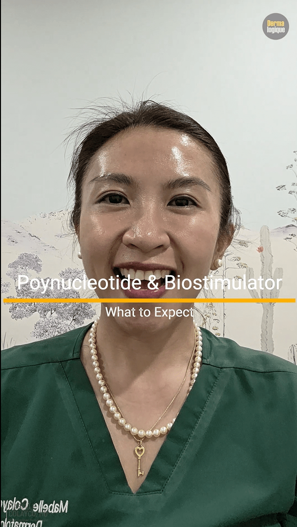 What to Expect After Polynucleotide and Biostimulator&nbsp;Injections