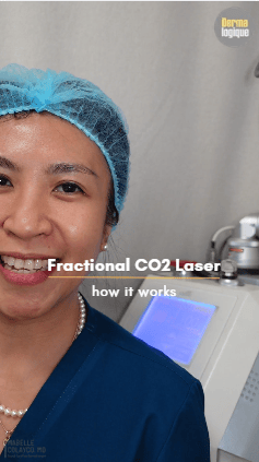 How Does Fractional CO2 Laser&nbsp;Work?